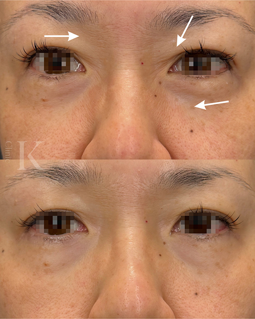 クリケイのブレッシングはこれらのお悩みに直接アプローチ