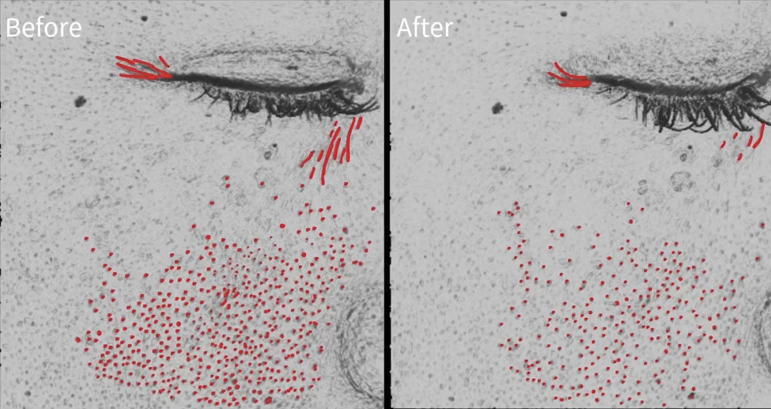 BLESSING(ブレッシング)で期待できる効果とは？