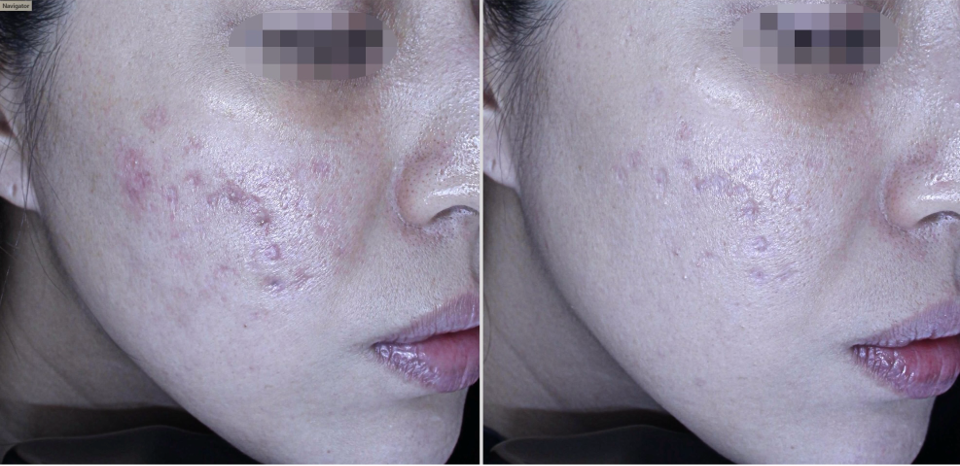 クリケイのキュアジェットはこれらのお悩みに直接アプローチ