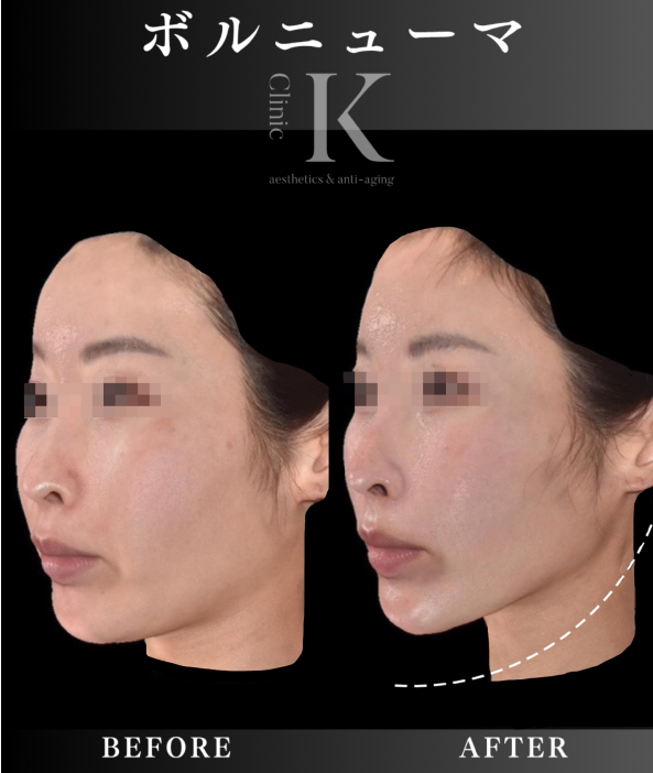 クリケイのボルニューマはこれらのお悩みにガッツリアプローチ