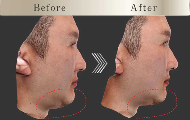 クリケイのボルニューマはここが違う!