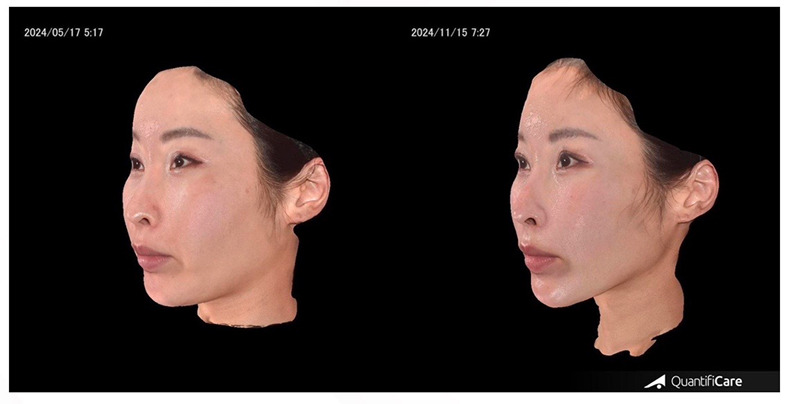 ボルニューマで期待できる効果とは?