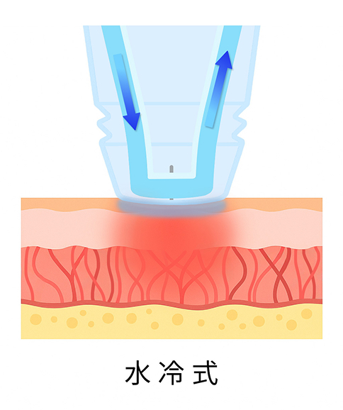 痛みと安全性への配慮