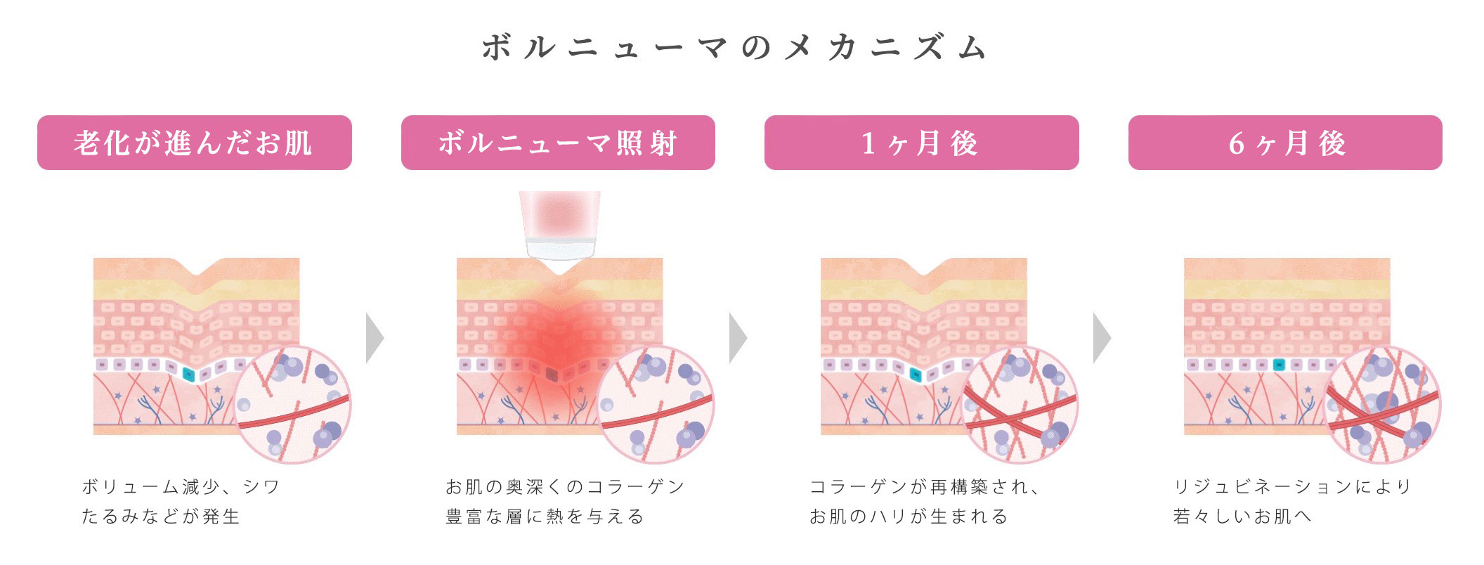 ボルニューマとは?
