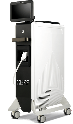 XERF