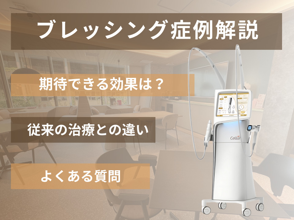 ブレッシング治療の症例解説｜韓国人医師が効果やダウンタイムを詳説