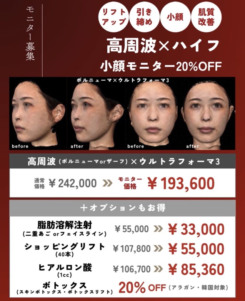 画像に alt 属性が指定されていません。ファイル名: IMG_4787-833x1024.jpeg