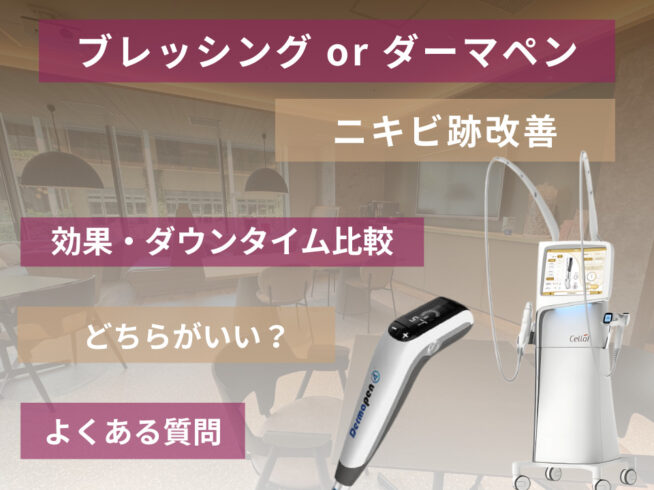 ブレッシングとダーマペンを徹底比較!クレーターやニキビ跡に効くのはどっち?効果やダウンタイムの違いを解説