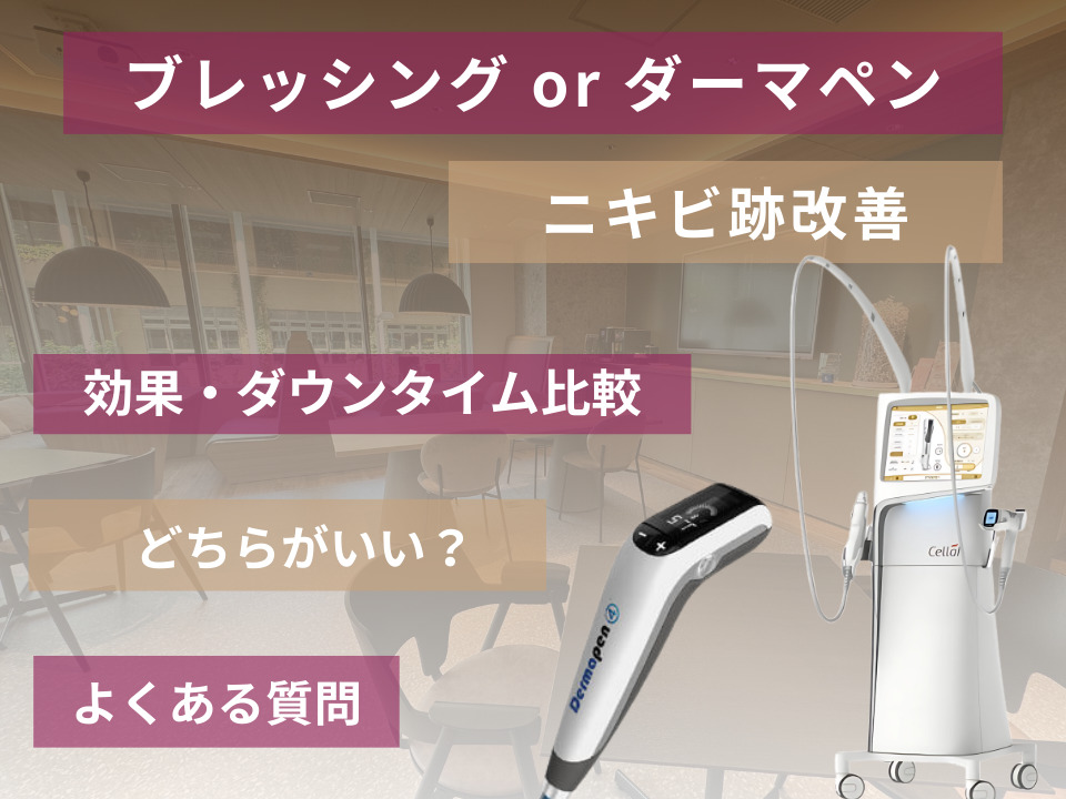 ブレッシングとダーマペンを徹底比較！クレーターやニキビ跡に効くのはどっち？効果やダウンタイムの違いを解説